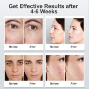 74 LED Beads for Complete Face Coverage